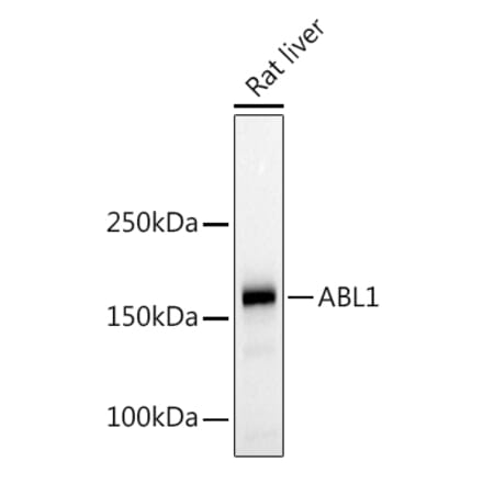 Western Blot - Anti-ABL1 Antibody (A12600) - Antibodies.com