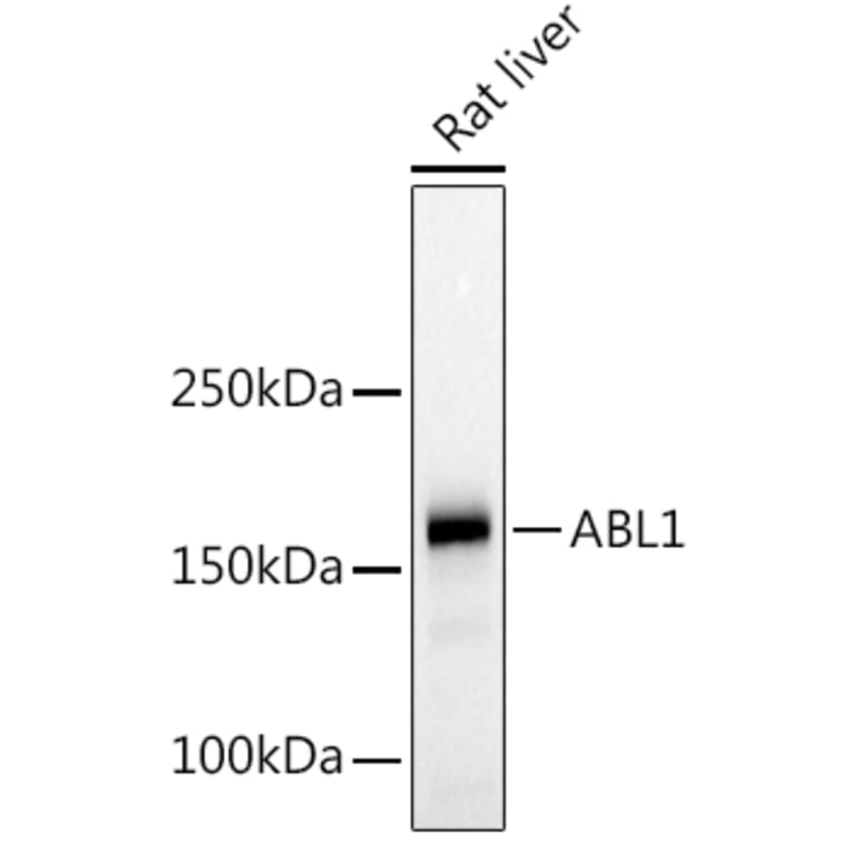 Western Blot - Anti-ABL1 Antibody (A12600) - Antibodies.com