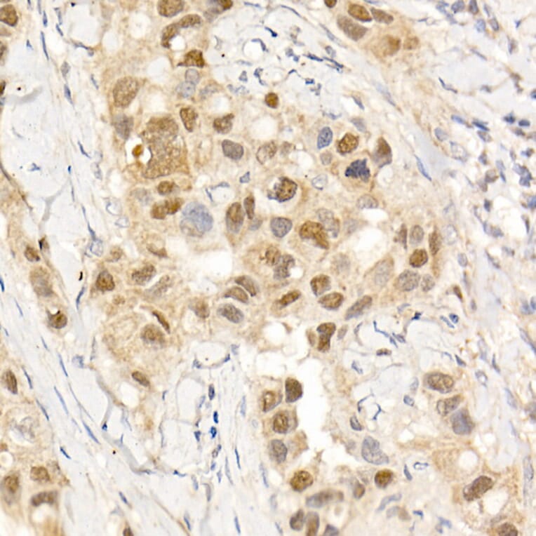 Immunohistochemistry - Anti-ABL1 Antibody (A12600) - Antibodies.com