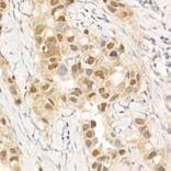 Immunohistochemistry - Anti-ABL1 Antibody (A12600) - Antibodies.com