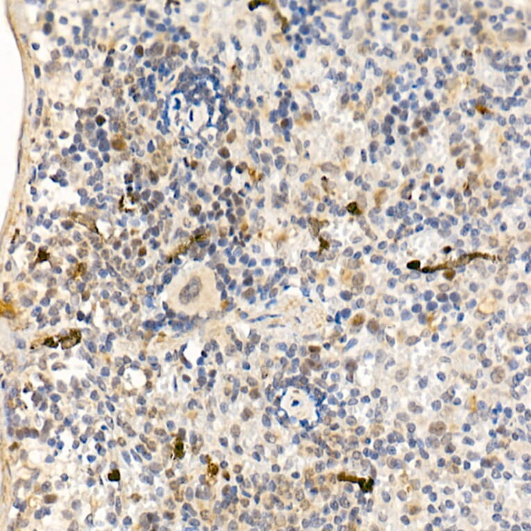 Immunohistochemistry - Anti-ABL1 Antibody (A12600) - Antibodies.com