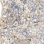 Immunohistochemistry - Anti-ABL1 Antibody (A12600) - Antibodies.com