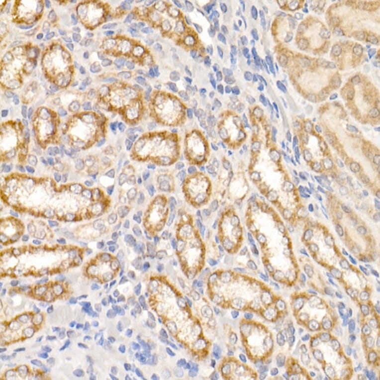 Immunohistochemistry - Anti-ABL1 Antibody (A12600) - Antibodies.com