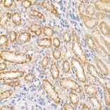 Immunohistochemistry - Anti-ABL1 Antibody (A12600) - Antibodies.com