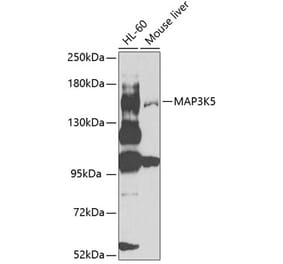 Western Blot - Anti-ASK1 Antibody (A12601) - Antibodies.com
