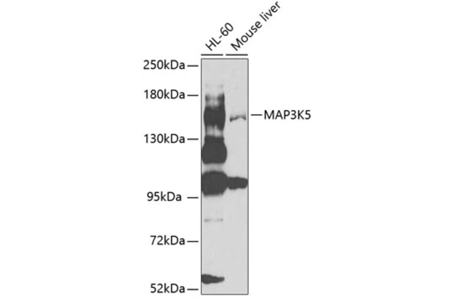 Western Blot - Anti-ASK1 Antibody (A12601) - Antibodies.com