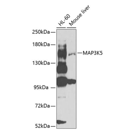 Western Blot - Anti-ASK1 Antibody (A12601) - Antibodies.com