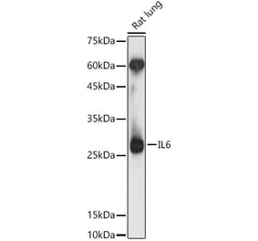 Western Blot - Anti-IL-6 Antibody (A12602) - Antibodies.com