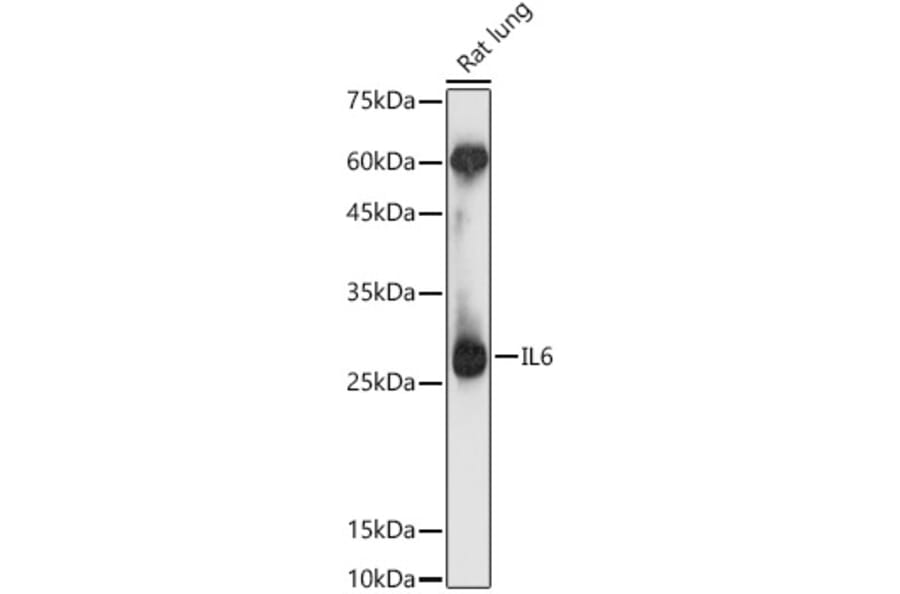 Western Blot - Anti-IL-6 Antibody (A12602) - Antibodies.com