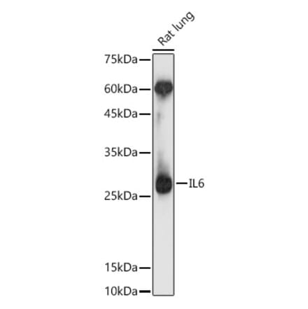 Western Blot - Anti-IL-6 Antibody (A12602) - Antibodies.com