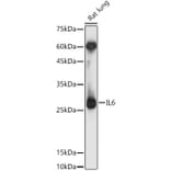 Western Blot - Anti-IL-6 Antibody (A12602) - Antibodies.com