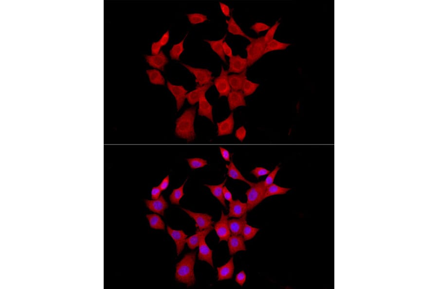 Immunofluorescence - Anti-IL-6 Antibody (A12602) - Antibodies.com