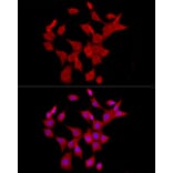 Immunofluorescence - Anti-IL-6 Antibody (A12602) - Antibodies.com