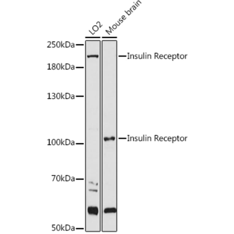 Western Blot - Anti-Insulin Receptor alpha Antibody (A12603) - Antibodies.com
