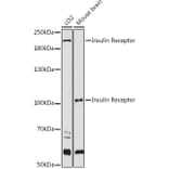 Western Blot - Anti-Insulin Receptor alpha Antibody (A12603) - Antibodies.com