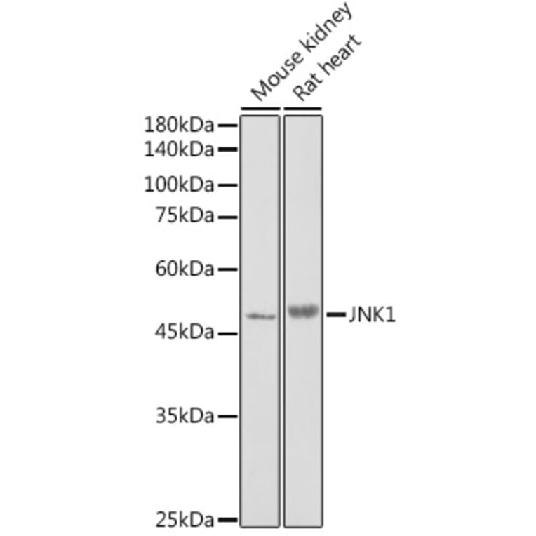 Western Blot - Anti-JNK1 Antibody (A12604) - Antibodies.com