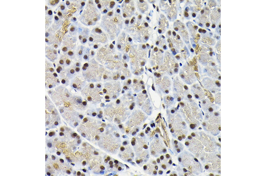 Immunohistochemistry - Anti-JNK1 Antibody (A12604) - Antibodies.com
