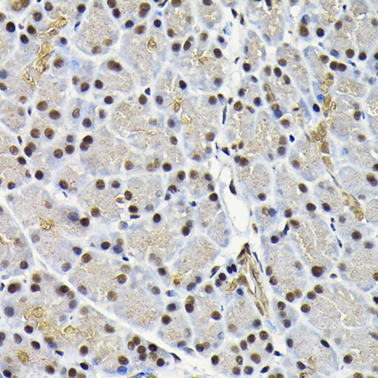 Immunohistochemistry - Anti-JNK1 Antibody (A12604) - Antibodies.com