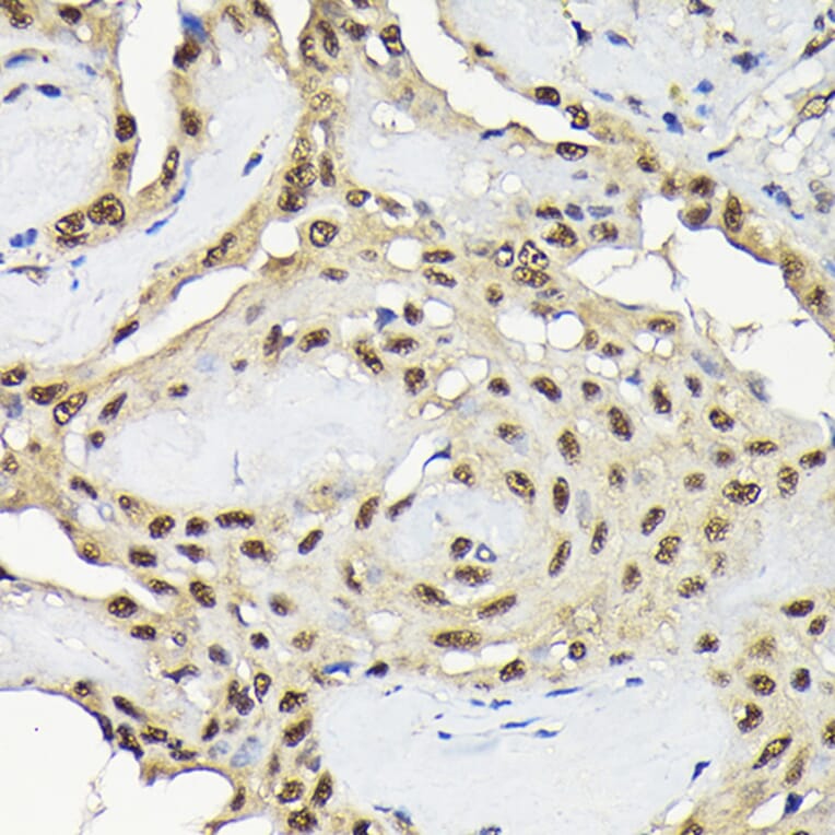 Immunohistochemistry - Anti-JNK1 Antibody (A12604) - Antibodies.com