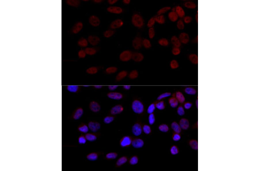 Immunofluorescence - Anti-JNK1 Antibody (A12604) - Antibodies.com