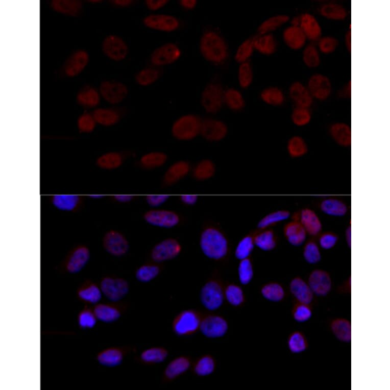 Immunofluorescence - Anti-JNK1 Antibody (A12604) - Antibodies.com