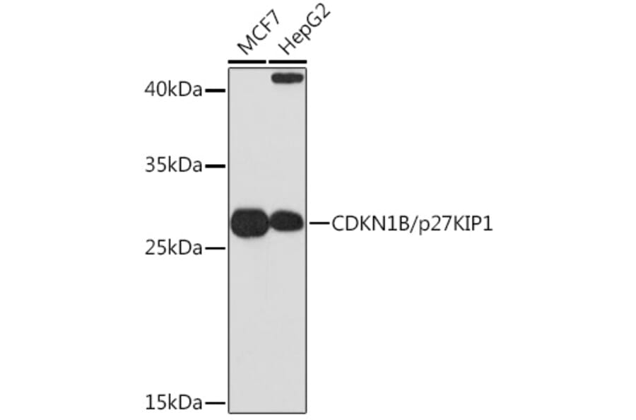 Western Blot - Anti-p27 KIP 1 Antibody (A12605) - Antibodies.com