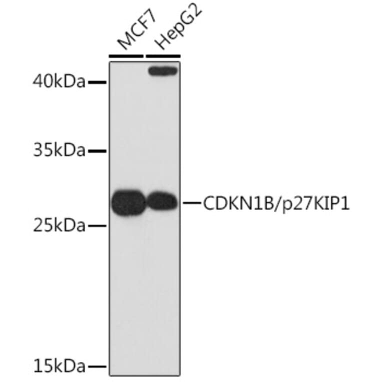 Western Blot - Anti-p27 KIP 1 Antibody (A12605) - Antibodies.com
