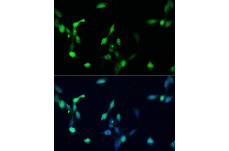 Immunofluorescence - Anti-p27 KIP 1 Antibody (A12605) - Antibodies.com