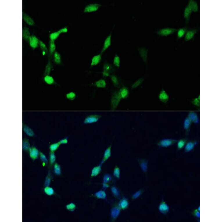 Immunofluorescence - Anti-p27 KIP 1 Antibody (A12605) - Antibodies.com