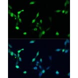 Immunofluorescence - Anti-p27 KIP 1 Antibody (A12605) - Antibodies.com