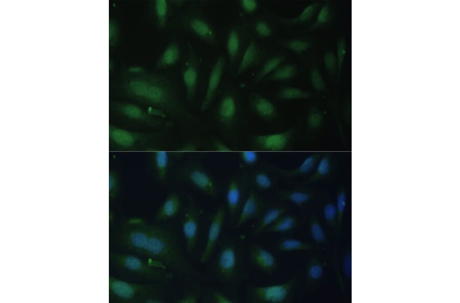 Immunofluorescence - Anti-p27 KIP 1 Antibody (A12605) - Antibodies.com
