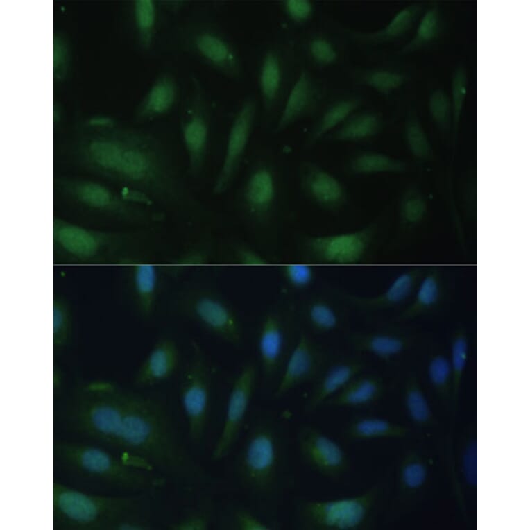 Immunofluorescence - Anti-p27 KIP 1 Antibody (A12605) - Antibodies.com