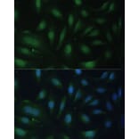 Immunofluorescence - Anti-p27 KIP 1 Antibody (A12605) - Antibodies.com
