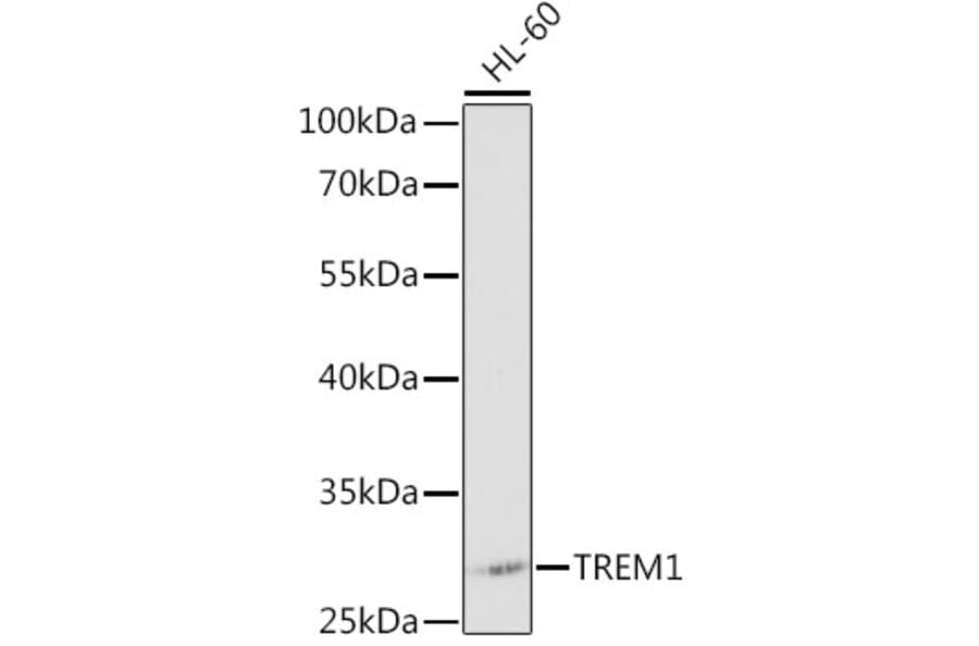 Western Blot - Anti-TREM1 Antibody (A12606) - Antibodies.com