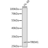 Western Blot - Anti-TREM1 Antibody (A12606) - Antibodies.com