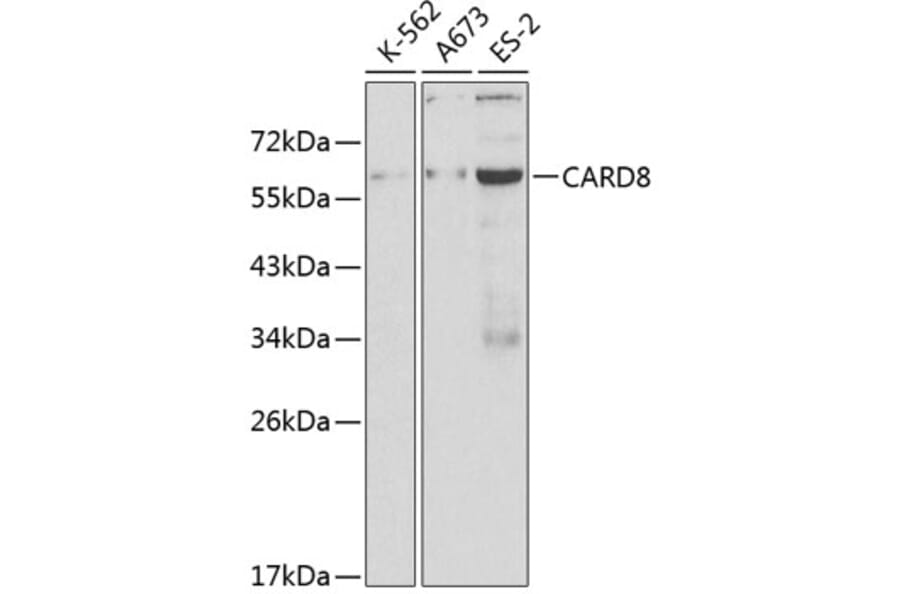 Western Blot - Anti-CARD8 Antibody (A12607) - Antibodies.com