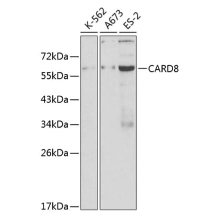 Western Blot - Anti-CARD8 Antibody (A12607) - Antibodies.com