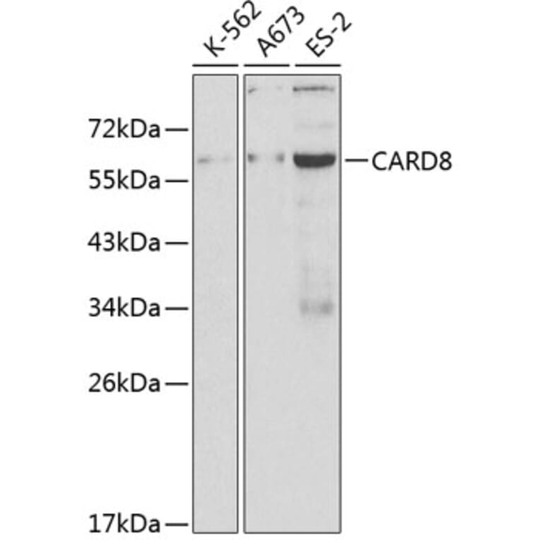 Western Blot - Anti-CARD8 Antibody (A12607) - Antibodies.com