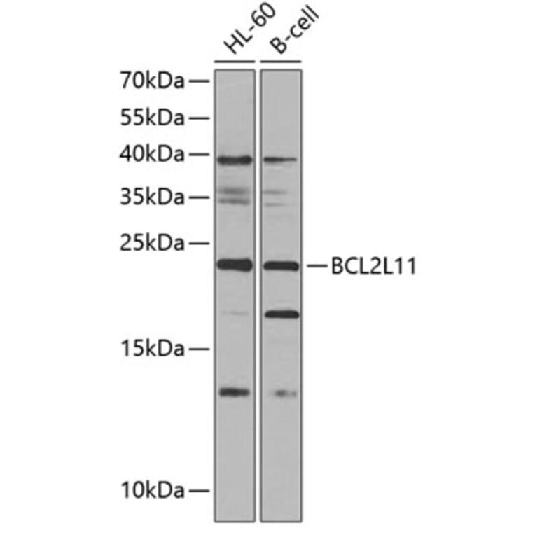 Western Blot - Anti-BCL2L11 Antibody (A0295) - Antibodies.com