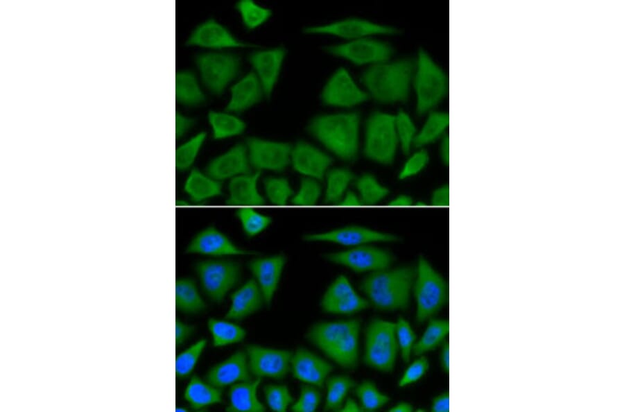 Immunofluorescence - Anti-BCL2L11 Antibody (A0295) - Antibodies.com