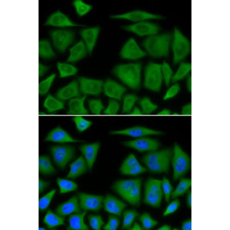 Immunofluorescence - Anti-BCL2L11 Antibody (A0295) - Antibodies.com