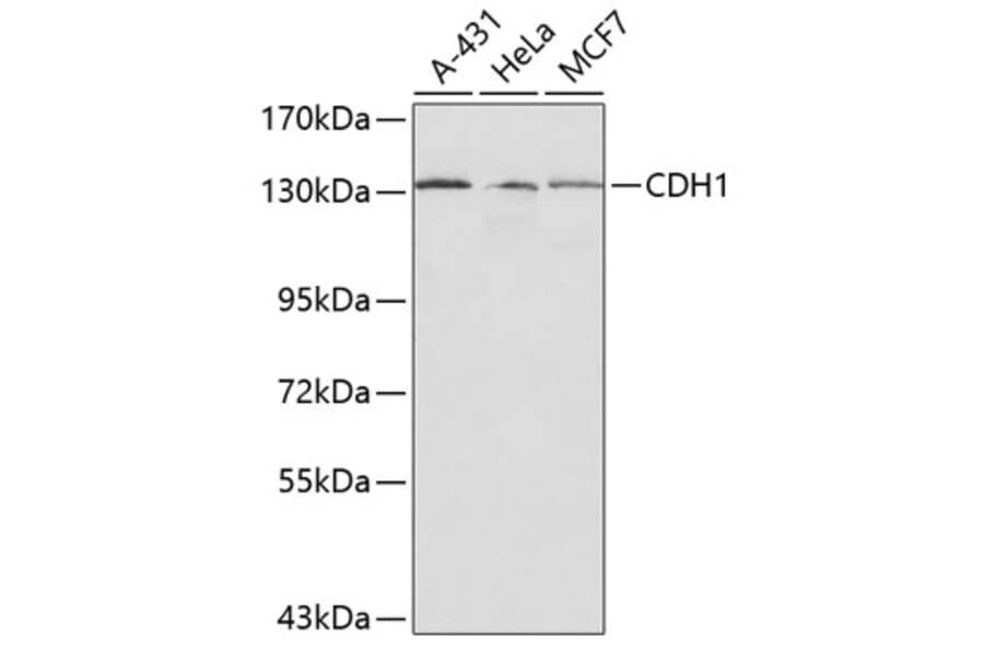Western Blot - Anti-CDH1 Antibody (A0314) - Antibodies.com