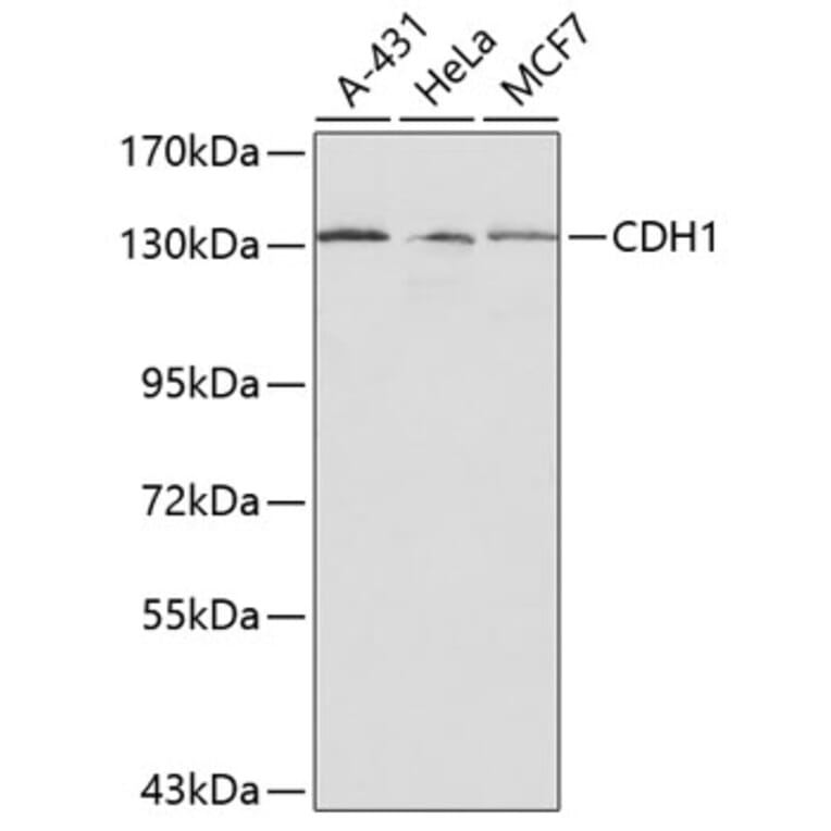 Western Blot - Anti-CDH1 Antibody (A0314) - Antibodies.com