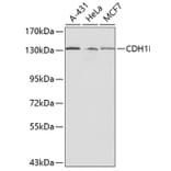 Western Blot - Anti-CDH1 Antibody (A0314) - Antibodies.com