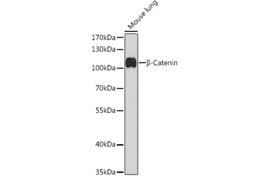 Western Blot - Anti-beta Catenin Antibody (A12611) - Antibodies.com
