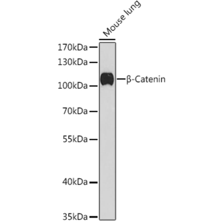 Western Blot - Anti-beta Catenin Antibody (A12611) - Antibodies.com
