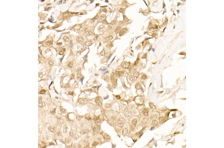Immunohistochemistry - Anti-beta Catenin Antibody (A12611) - Antibodies.com