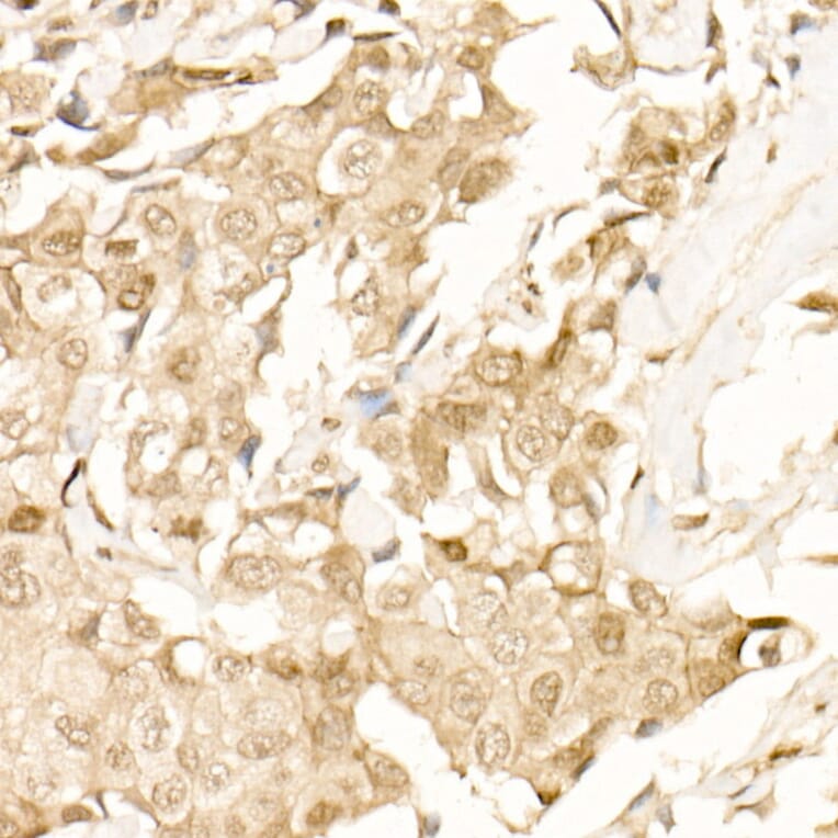 Immunohistochemistry - Anti-beta Catenin Antibody (A12611) - Antibodies.com