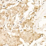 Immunohistochemistry - Anti-beta Catenin Antibody (A12611) - Antibodies.com