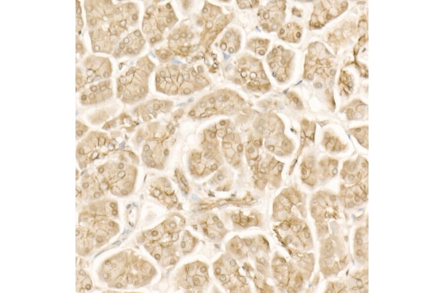 Immunohistochemistry - Anti-beta Catenin Antibody (A12611) - Antibodies.com